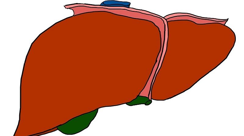 Alles wat u moet weten over NAFLD