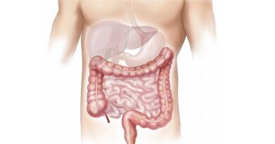 A Crohn-betegség természetes kezeléssel való kezelésének módja