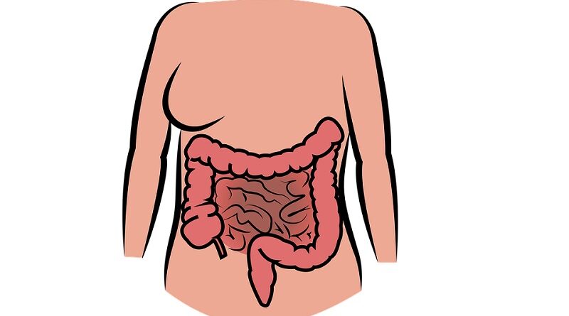 大腸の袋が炎症を起こす憩室炎について