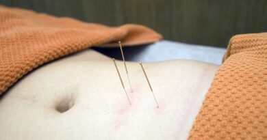 Agopuntura e motivi di salute per provare l'agopuntura