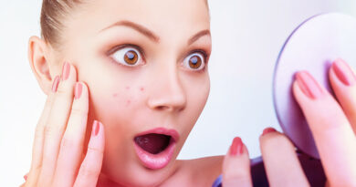 I problemi di salute sono indicati da diversi tipi di brufoli e acne della pelle