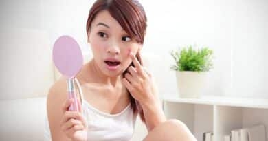 ニキビや吹き出物がよくできる？あなたは、その理由に驚くでしょう