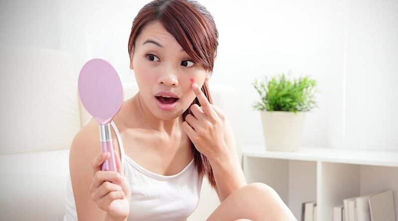ニキビや吹き出物がよくできる？あなたは、その理由に驚くでしょう