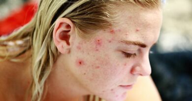Probleme ale pielii care indică probleme de sănătate mai profunde