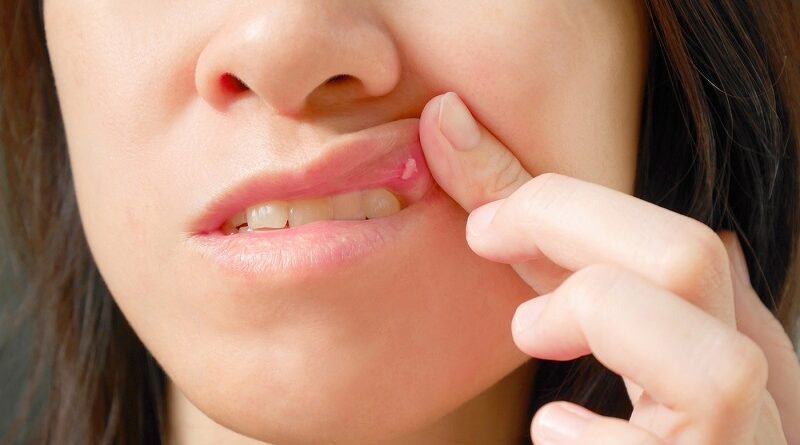 歯ぐきを健康にする方法